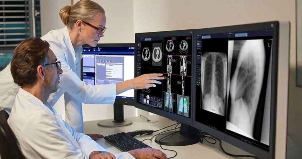 Radiology Tech Salary